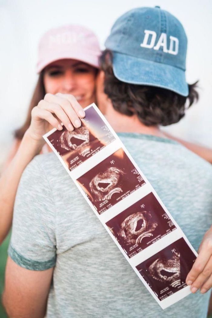 man and woman hugging, wearing blue and pink caps, mom and dad, gender reveal decorations, baby sonogram