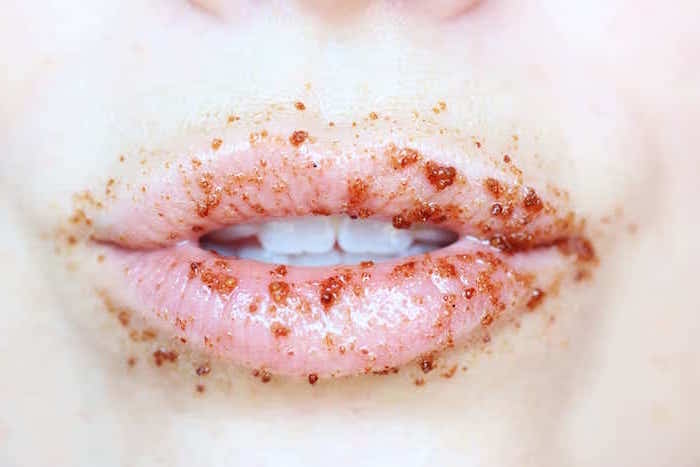homemade lip scrub with brown sugar honey and olive oil applied on lips close up photo