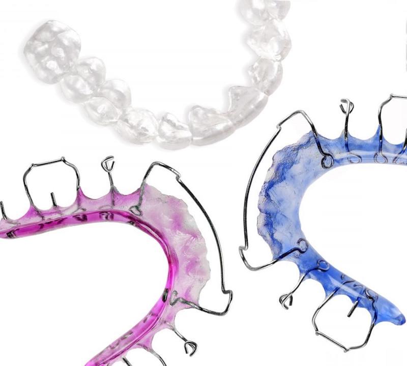 how to clean retainers with plaque different colored retainers