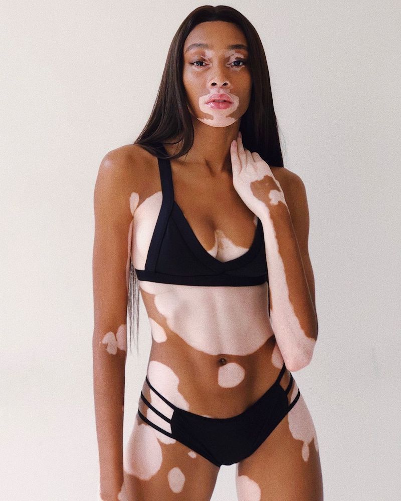 ashwagandha dosage winnie harlow