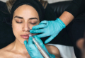 10 Things You Need To Know Before Getting Hyaluronic Acid Lip Fillers