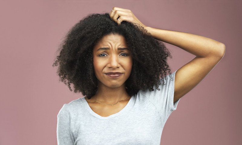 How To Get Rid Of Dandruff: 7+ Effective Remedies and Treatments