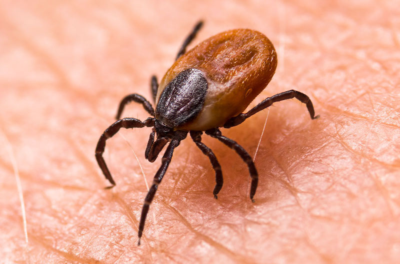 infected female deer tick on hairy human skin. ixodes ricinus. dangerous mite detail. acarus. infectious borreliosis