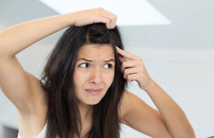 home remedies for dandruff woman with long black hair