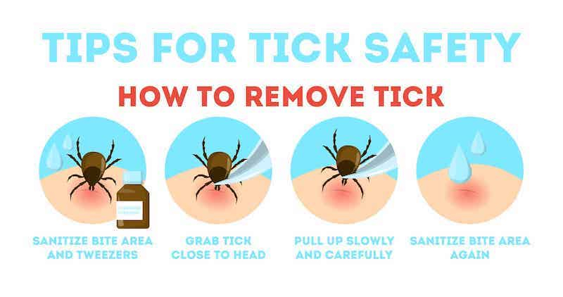 how to remove a tick safely infographic