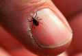 How To Remove a Tick: Everything You Need To Know