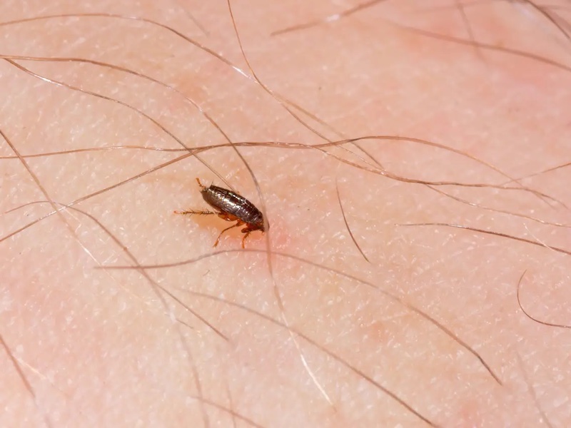 how to get rid of fleas in the house fela on top of human skin