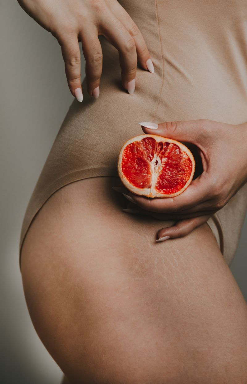 5 All-Natural Home Remedies Against Stretch Marks and Scars