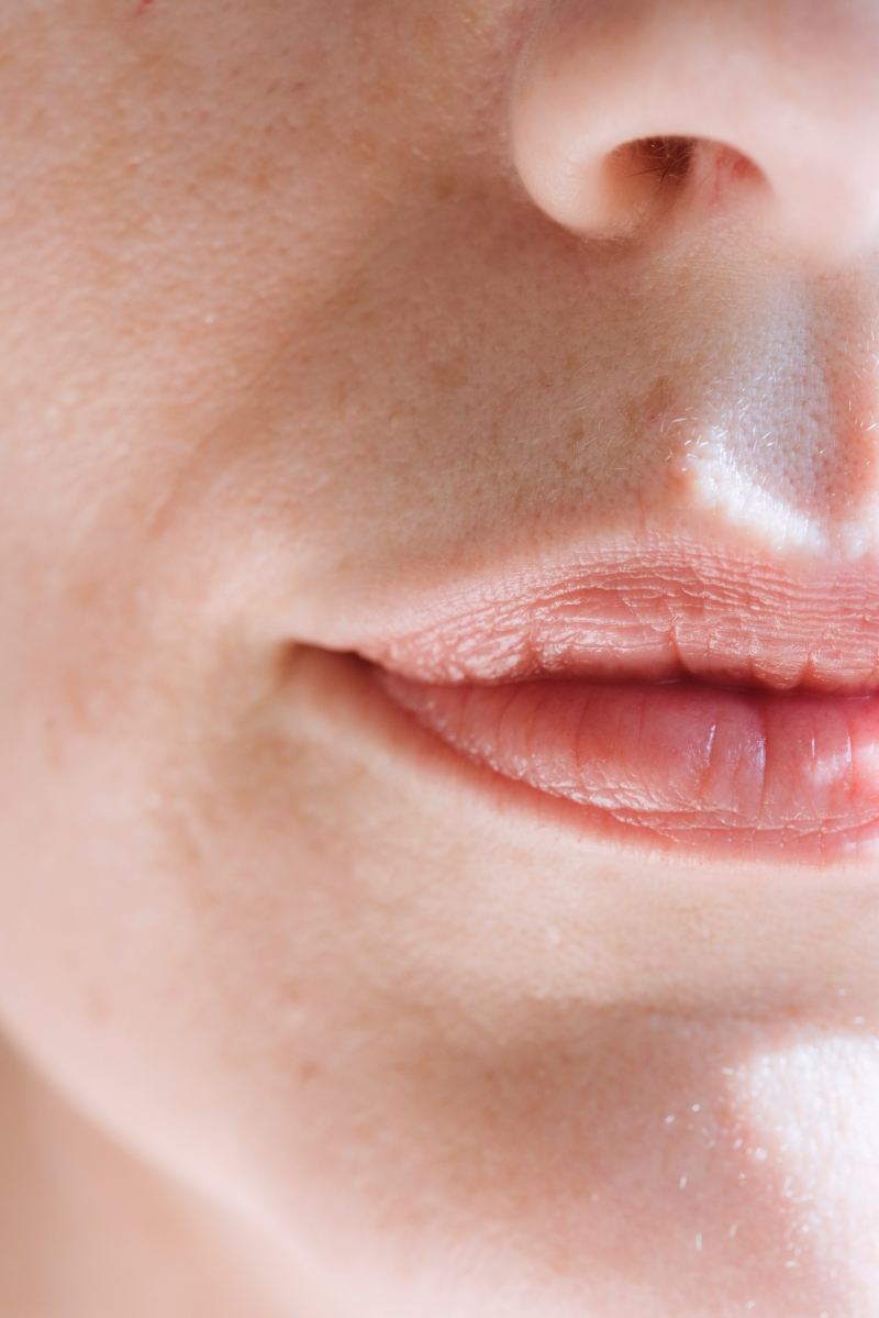 tips for chapped lips