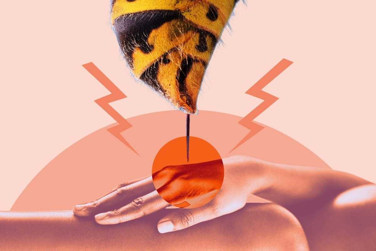 how to treat bee or wasp sting
