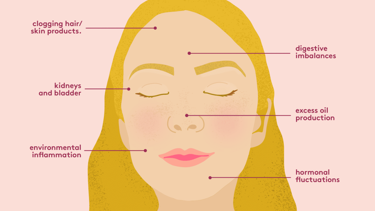 what acne says about your body