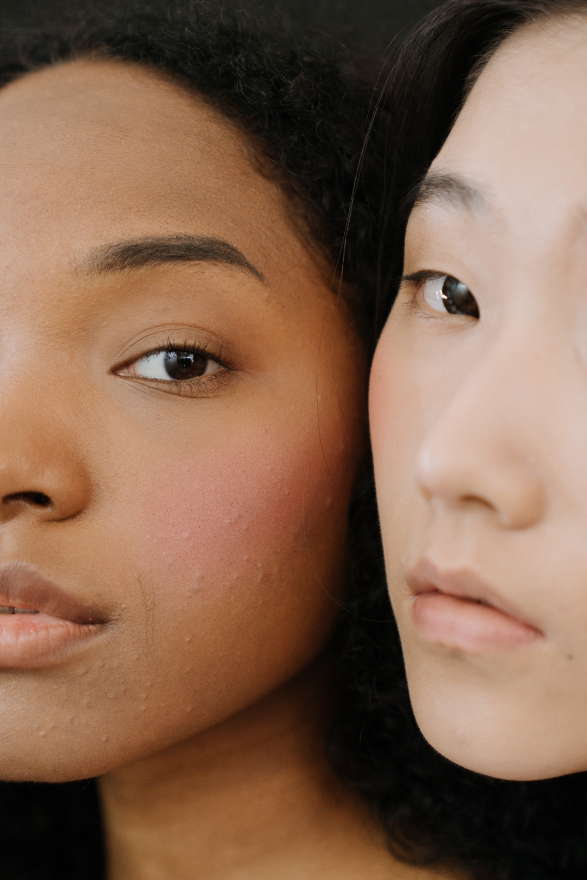 What Your Acne Says About Your Health, According to Science