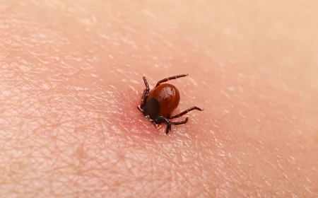 how to kill a tick tick burrowed in skin