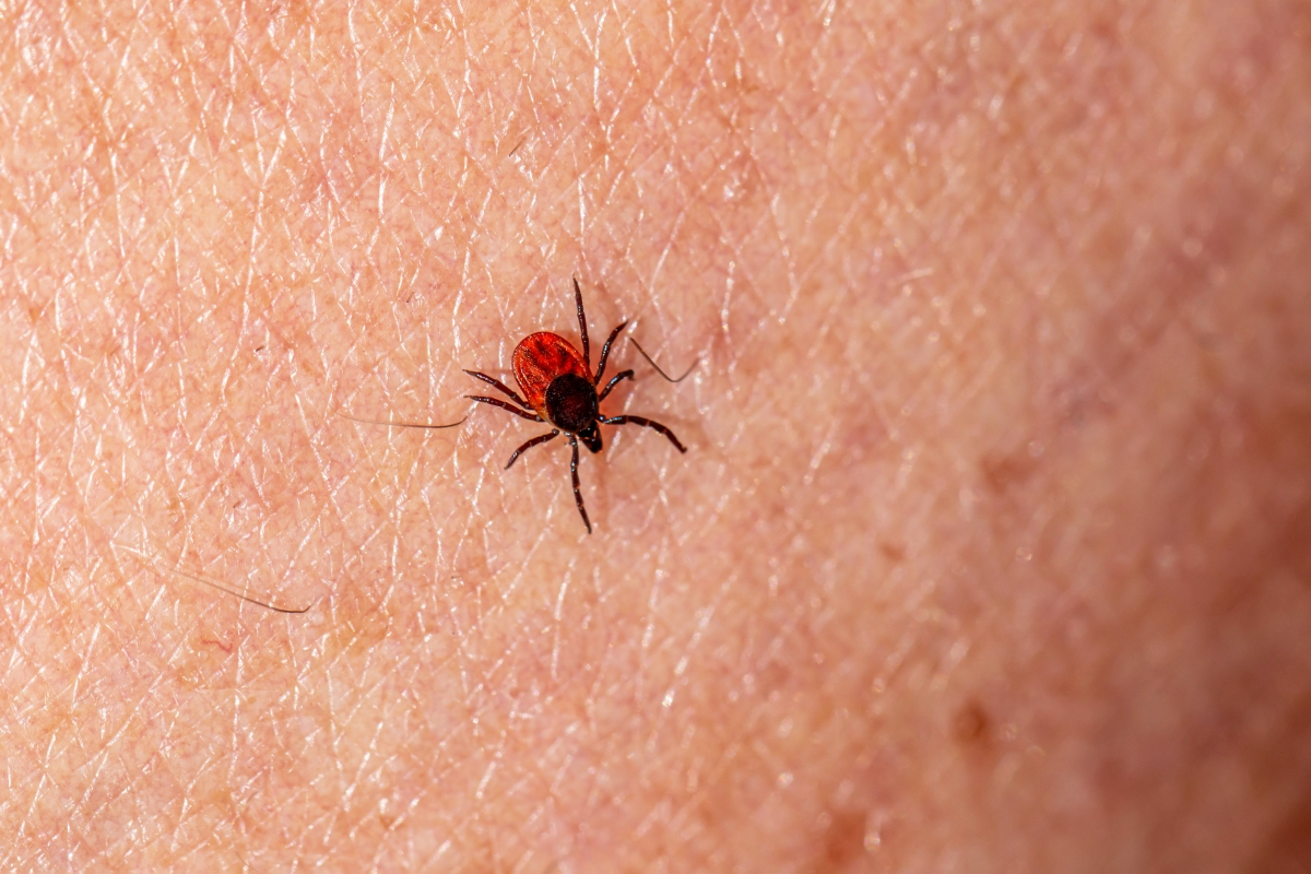 protect yourself from ticks and lyme disease