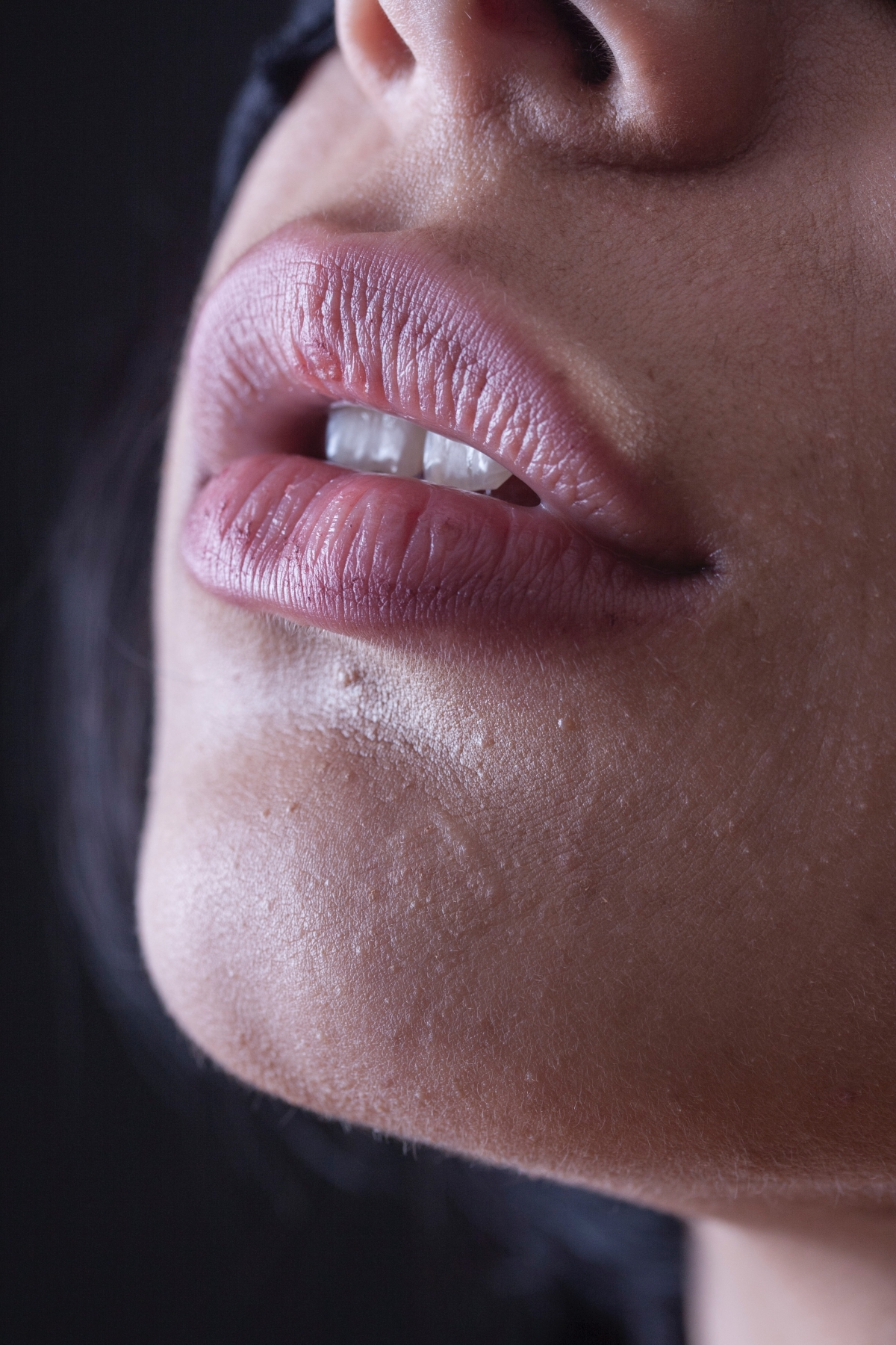 what do your lips tell about your health