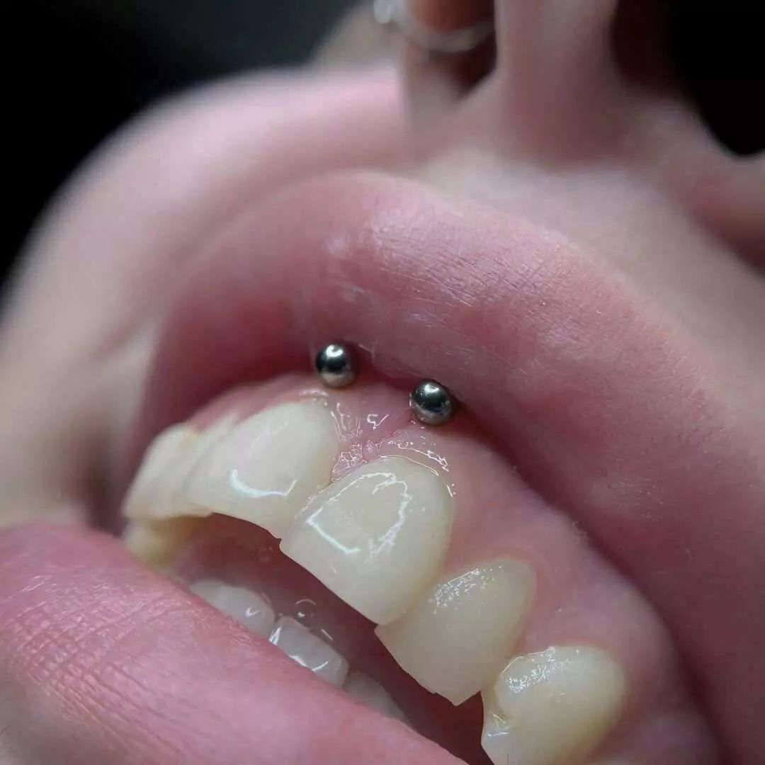 how long do smiley piercings take to heal