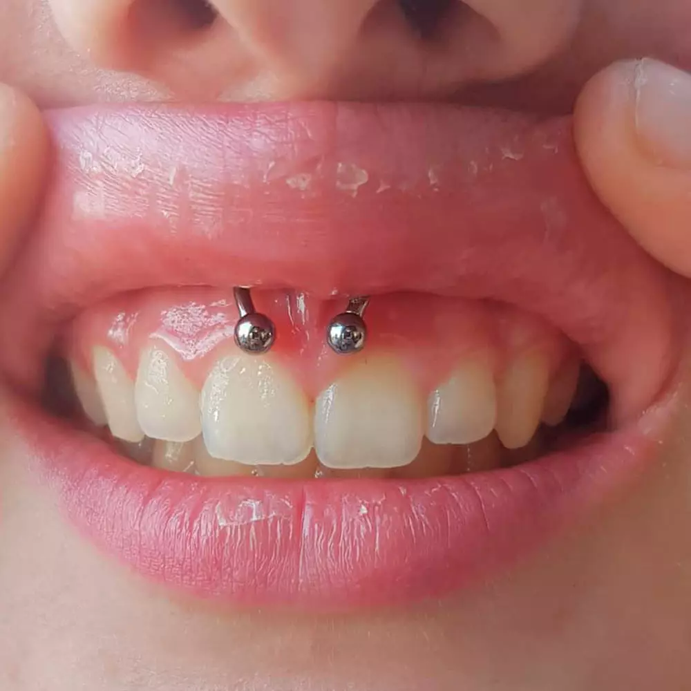 how to clean a smiley piercing.jpg