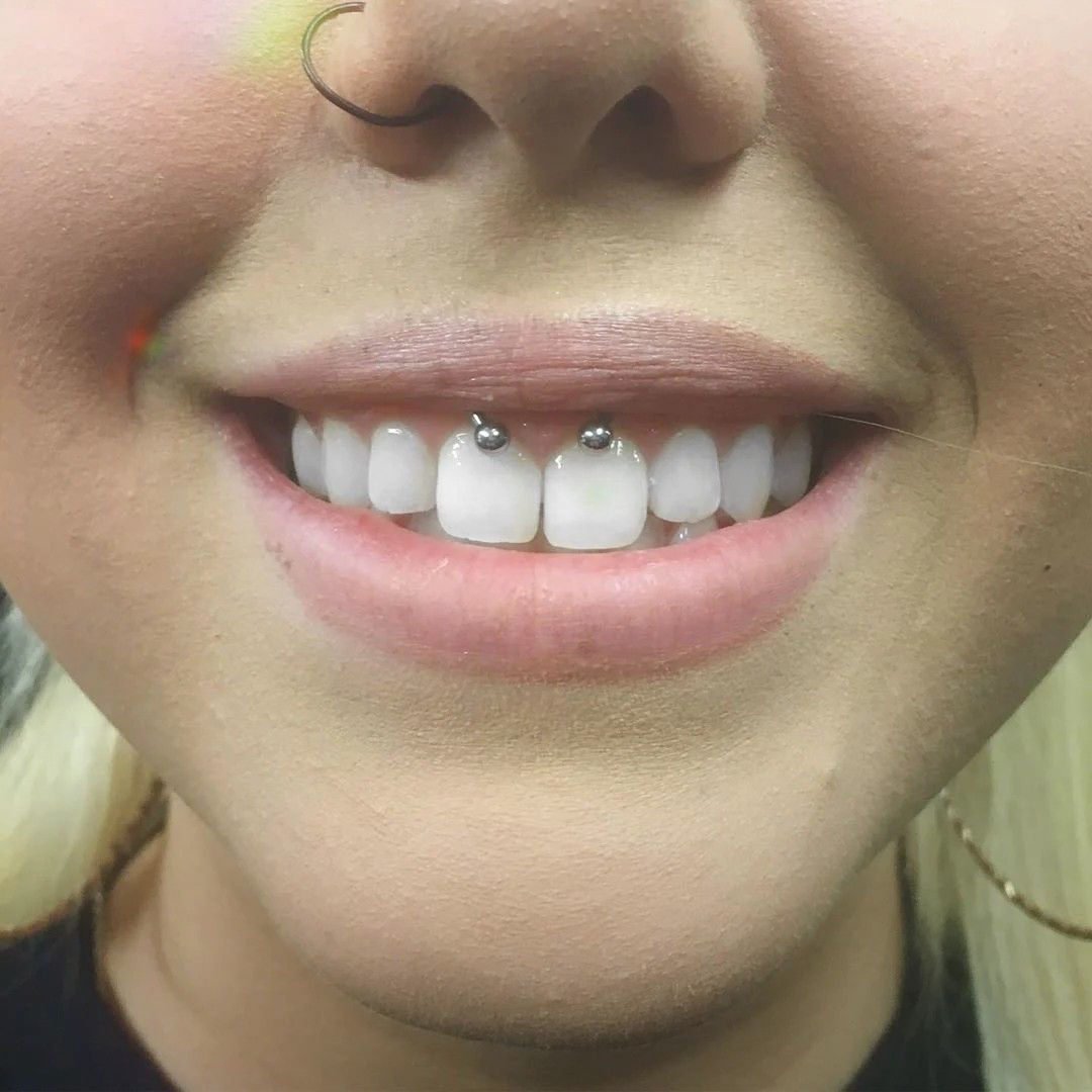 smiley piercing healing time