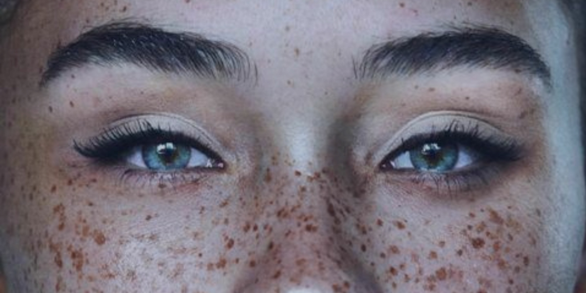 blue eyes and freckles