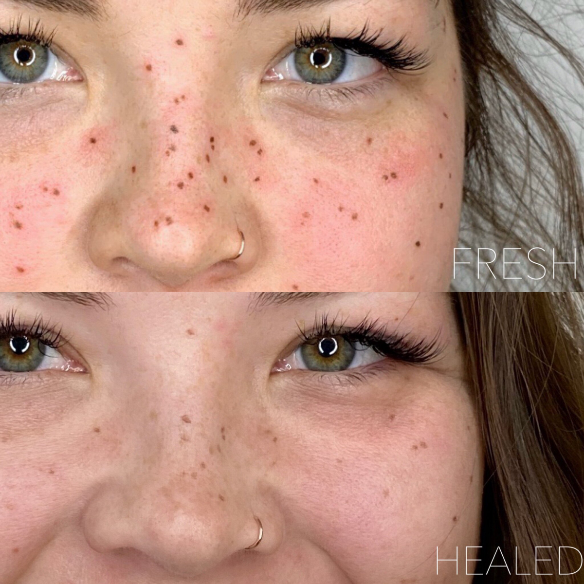 Permanent Beauty Everything You Need To Know About Tattoo Freckles