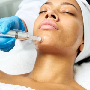 microneedling before and after woman getting treatment
