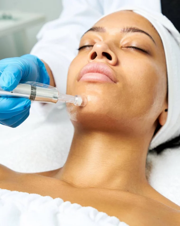 microneedling before and after woman getting treatment